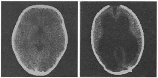 被人骂没脑子？科学家教你回怼，没脑子也能活得好