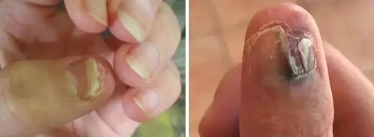 指甲刀中的劳斯莱斯,德国高端指甲剪指甲刀