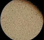 提醒：这5种卫生巾，用多了容易得妇科病！你还在用吗？