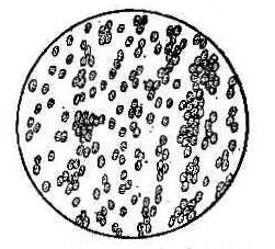 女性阴道炎科普知识,私密妇科养护