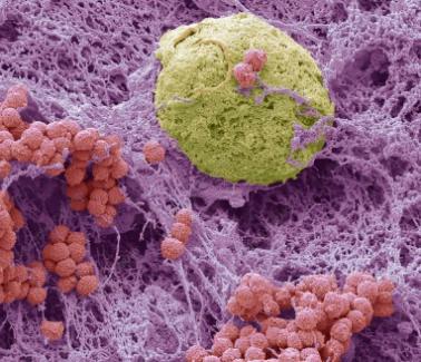 新冠肺炎的治疗指南最新,讲述新冠肺炎的症状与治疗