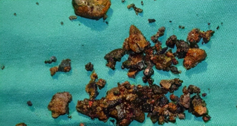 中药排肾结石真的有效果吗,肾结石中药排石药方大全