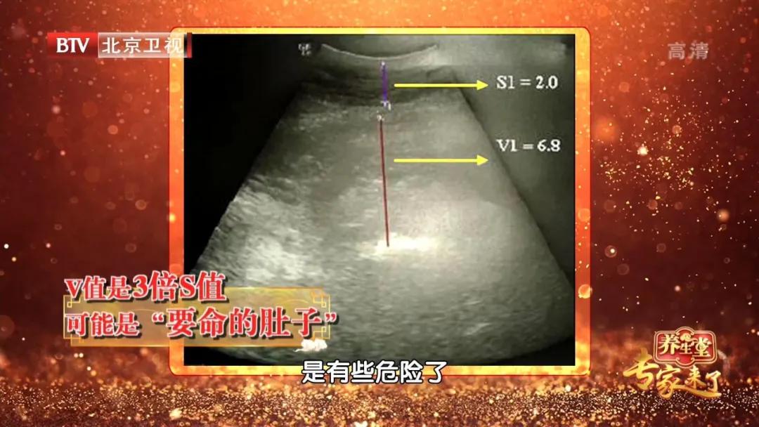 手法调理小肚子肥胖,腹部肥胖是百病之根