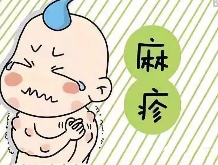 荨麻疹有什么症状和治疗方法,八个月宝宝麻疹的症状和治疗