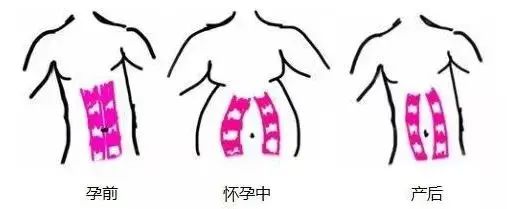 「爱禧课堂」生完孩子肚子还跟怀孕一样，原来是这样！