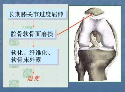 患了骨关节炎如何治疗,专治膝骨关节炎中草药