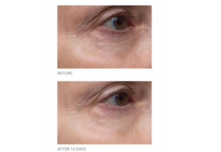 春夏护肤|消除黑眼圈才是首要任务