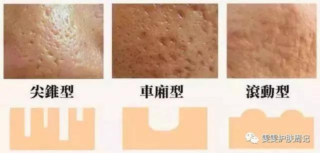 雯雯护肤笔记,雯雯护肤手法直播