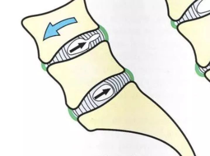 仰卧起坐器械锻炼腹肌,仰卧起坐是锻炼腹肌最好的方法