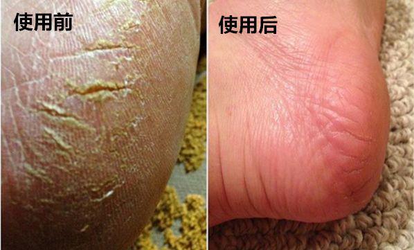 澳大利亚财政部长首推品牌，进国后让柳岩薇娅同时着迷，太疯狂了