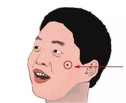 微创手术祛痣全过程,激光祛痣留疤失败案例