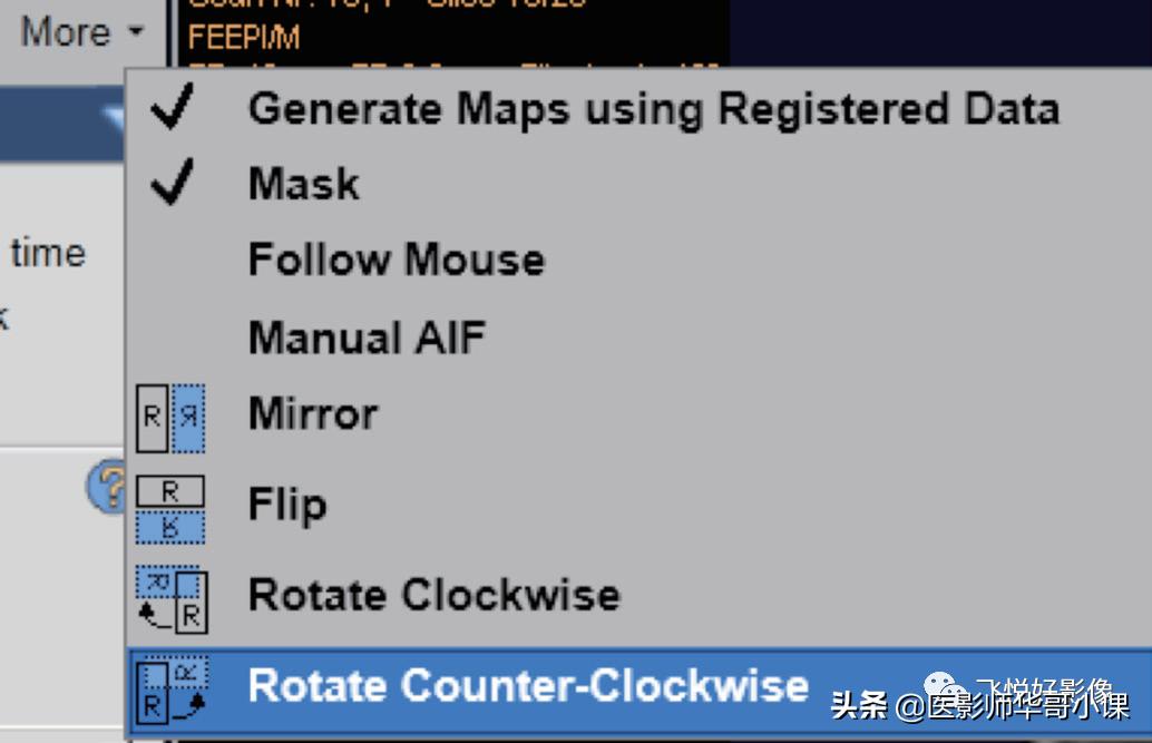 飞利浦磁共振脑灌注怎么测量,飞利浦核磁诊断教学