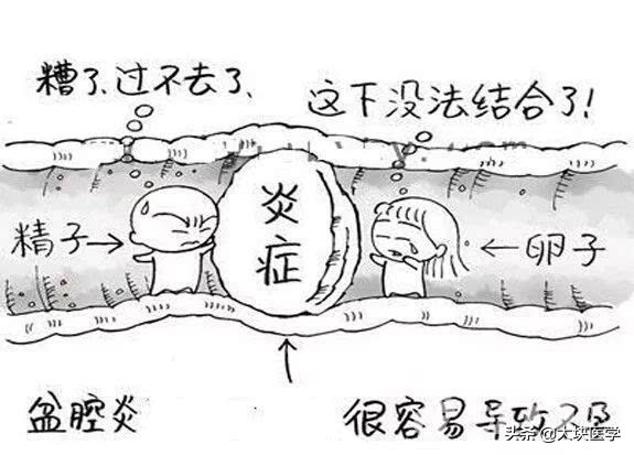 女人如何摆脱难“炎”之隐？