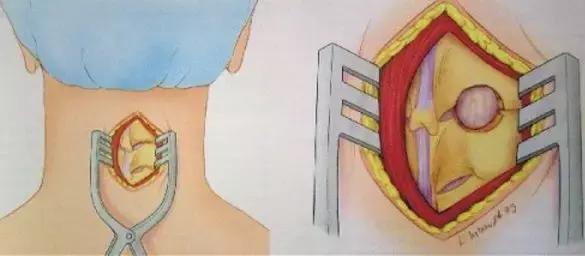 低头颈椎疼头晕如何缓解,科普头晕是怎么回事