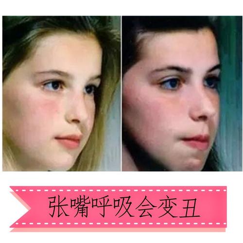 孩子换牙太早命不好,小孩换牙早是不是长不高