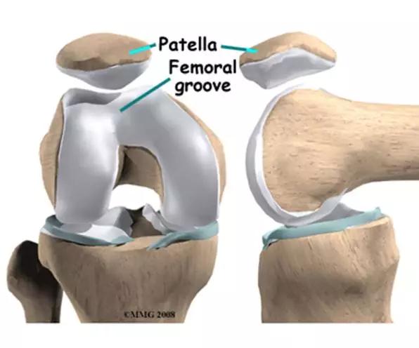 运动损伤膝盖一般用什么药,运动损伤膝盖疼怎么办