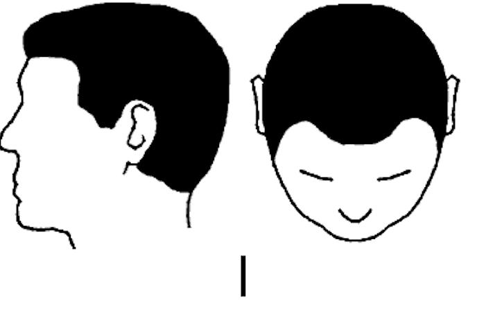 人到中年不得已都开始秃顶了,中年男人的三大危机秃顶发福