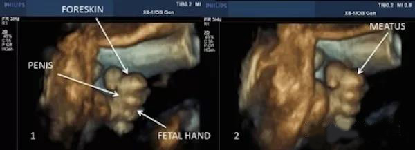 这么小的娃会踢被子,这么小的娃就会翘二郎腿了