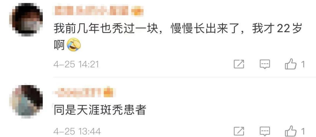 美女主持人突然上热搜，网友纷纷晒同款！脱发原来是毛囊“休息”了