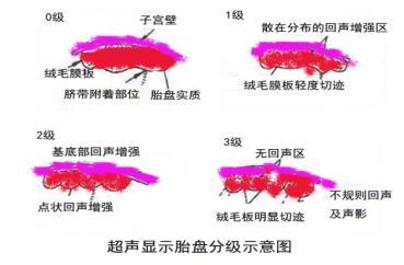 怀孕30-34周胎儿能长多少斤,孕期怎样控制体重宝宝生出来六斤