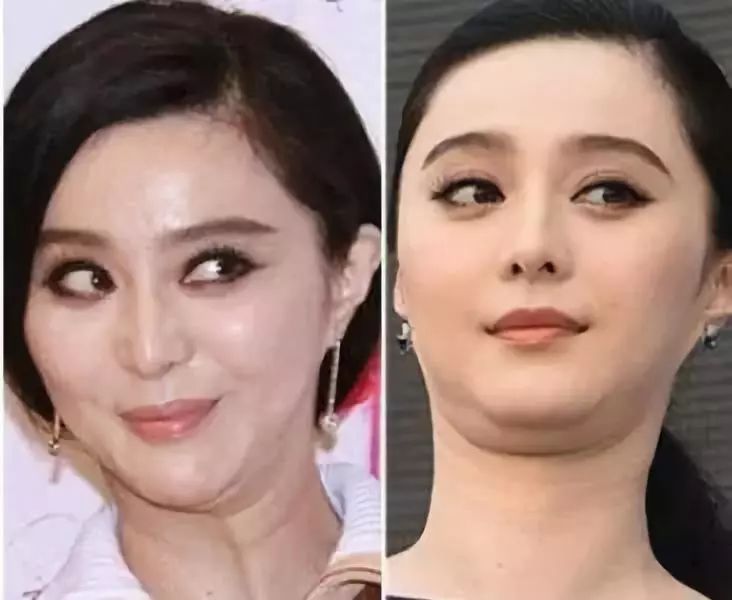 人不胖双下巴越来越严重是病吗,人不胖却有双下巴是怎么回事