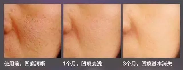 干粉冷冻,冷冻干粉的作用和功效