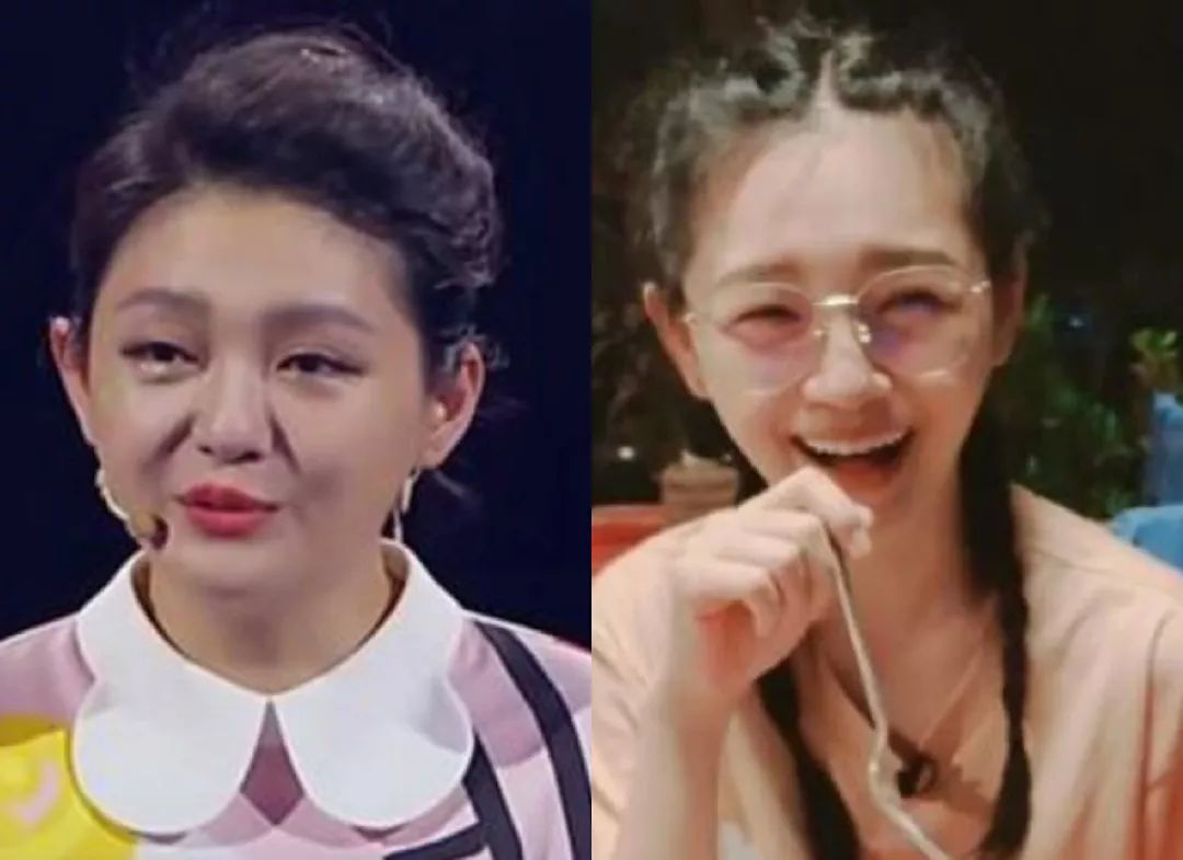 佟丽娅瘦脸前后判若两人不手术不打针如何瘦出一张无皱精致美人脸