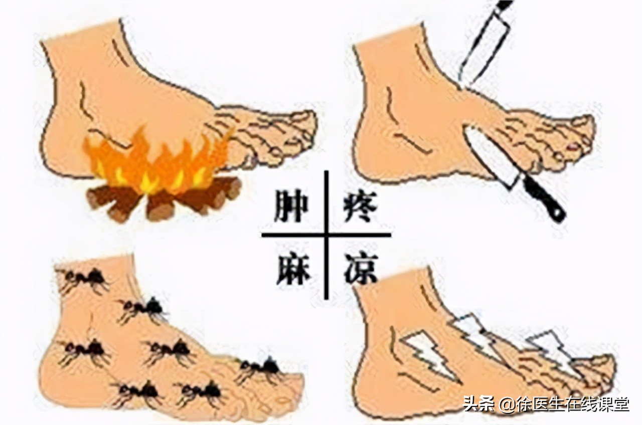 老年人脚底板疼怎么回事,老年人脚底板痛怎么回事怎么治