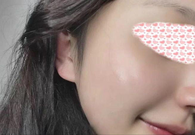 角质层薄的用什么产品最好,角质层薄注意事项及禁忌