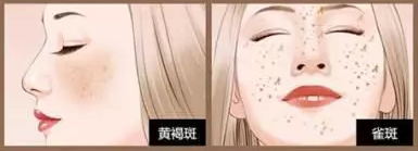 打美白针有副作用吗,常年打美白针有什么副作用吗