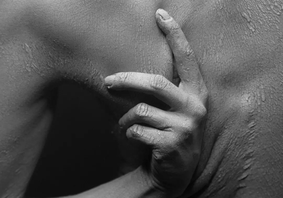 得了湿疹不要怕教你成功治愈方法,湿疹太难受学会这3招更管用