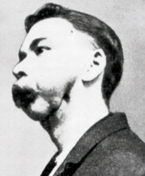 牙齿烂光，脸长巨瘤，骨头还会发光，被美国资本家逼向绝路的女工