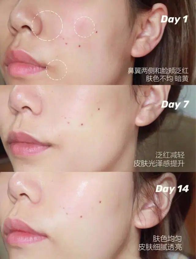 谁说女人过了三十就是黄脸婆,黄脸婆用什么护肤品最好