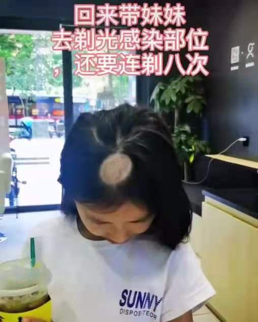 新手养猫怎么避免真菌头癣,养猫得猫癣头秃