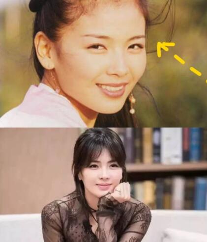 太阳穴凹陷颧弓外扩怎么画眉毛,太阳穴凹陷颧弓突出明显怎么化妆