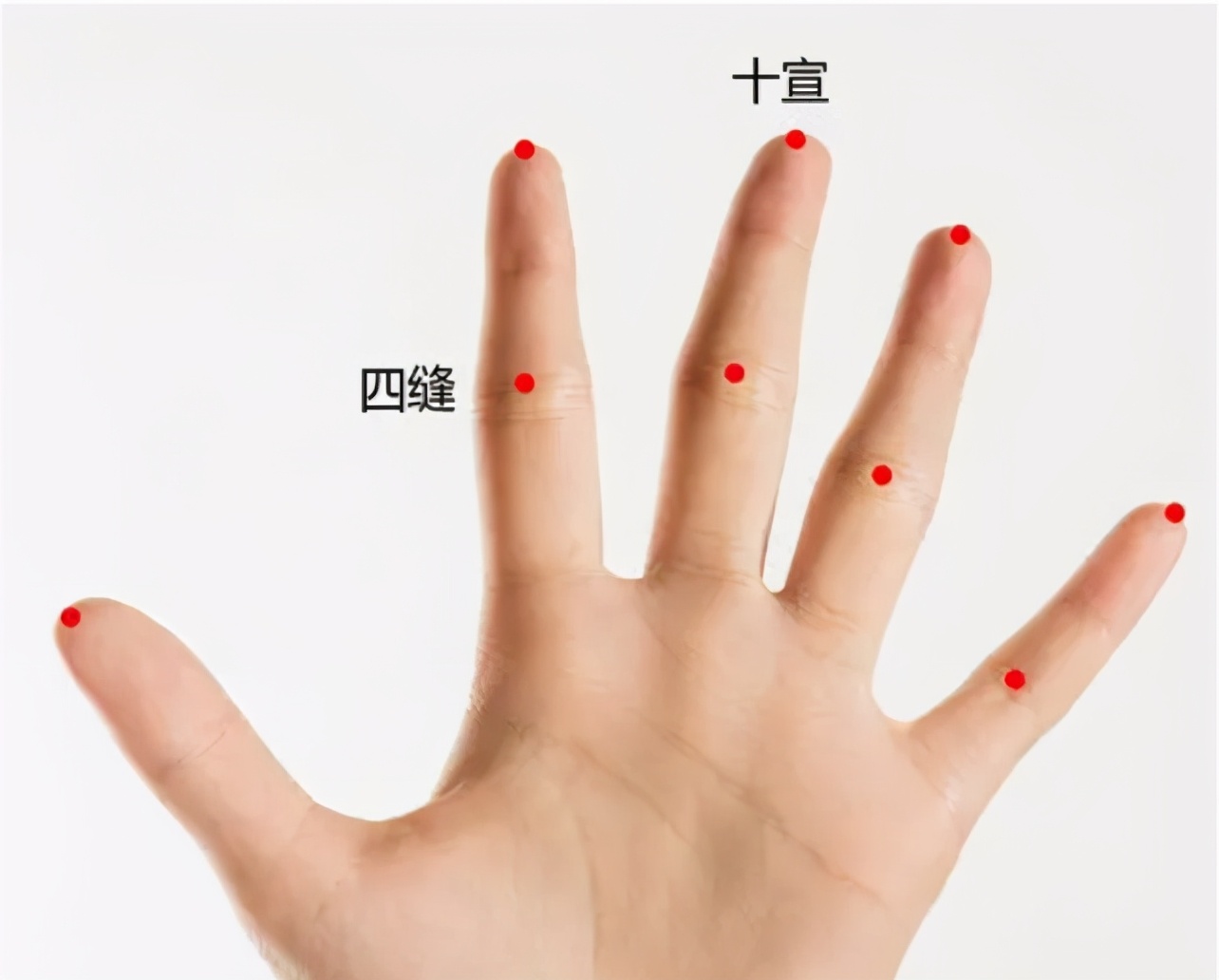 中医针灸常用的急救法，你知道吗？