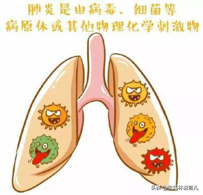 咳嗽肺炎的概率,咳嗽怀疑是新冠肺炎怎么办