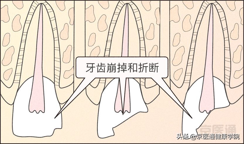 夜磨牙有什么危害吗,夜磨牙的危害