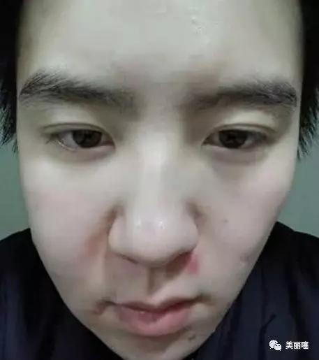 女生最丑的脸型梨形脸,女生脸型难看的表现