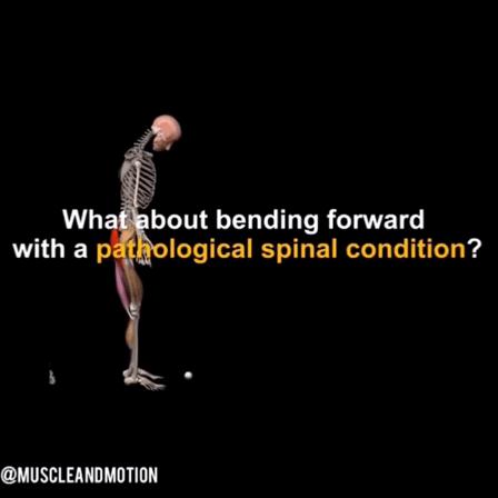 椎间盘的恢复,椎间盘恢复生理曲度方法