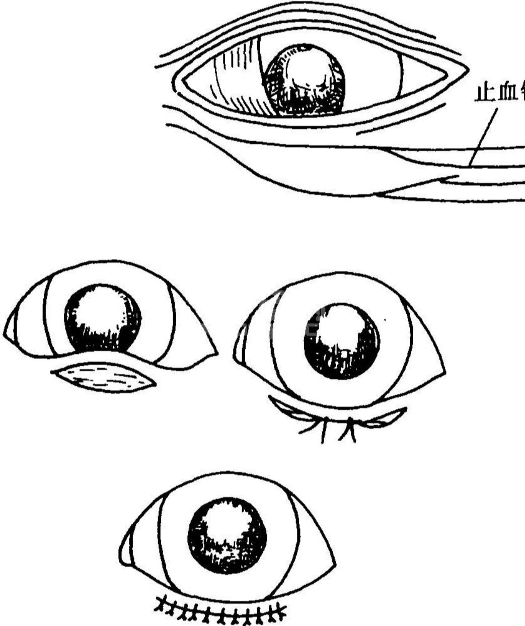 狗狗眼型怎么割双眼皮,狗狗双眼皮手术恢复