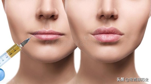 瘦脸针的5个常见问题,瘦脸针注意事项和方法