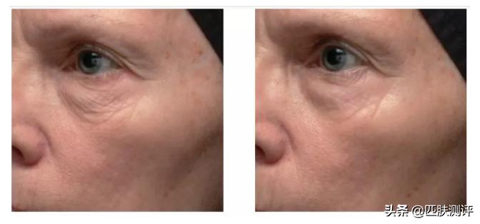 olay超a瓶和hbn哪个好,olay超a瓶真的好用吗