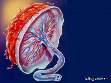 胎膜早破出血保胎成功案例,免疫问题会导致胎膜早破吗