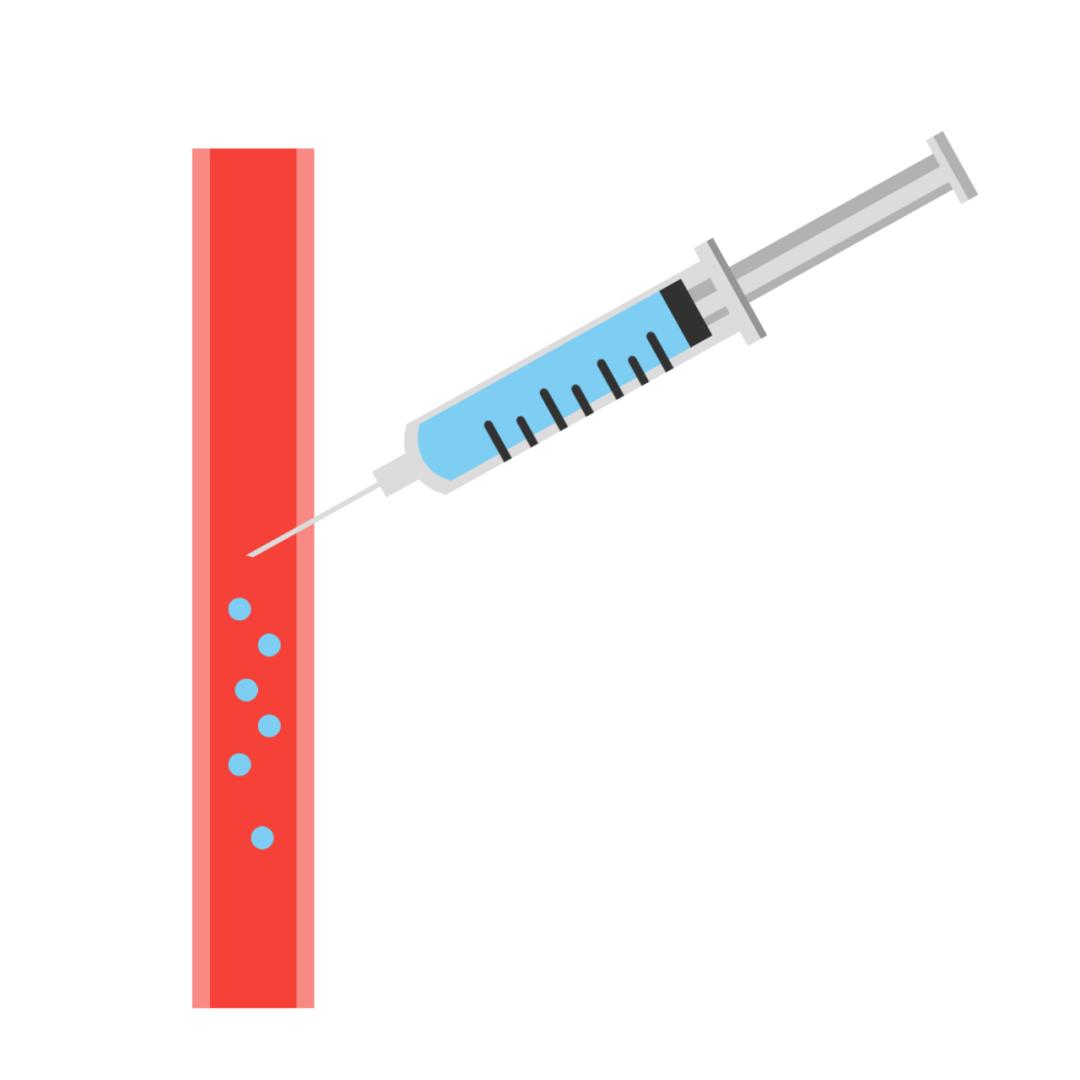 介入治疗肝癌能杀死癌细胞吗,介入治疗能把癌细胞饿死吗
