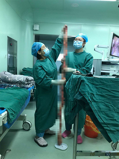 和平医院做息肉病理多少钱,和平医院做子宫肌瘤怎么样