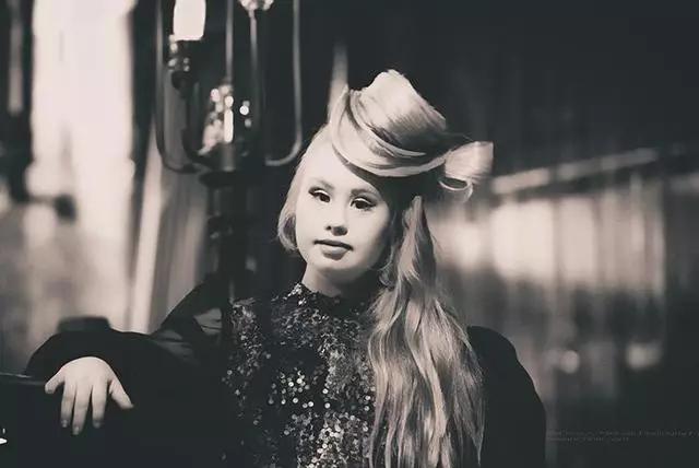 唐氏综合征中国美女,患有唐氏综合征的维密模特