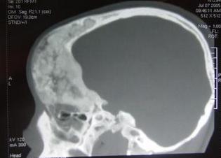 宝宝磕到头去医院查什么,小孩不小心磕到头一定要去医院吗