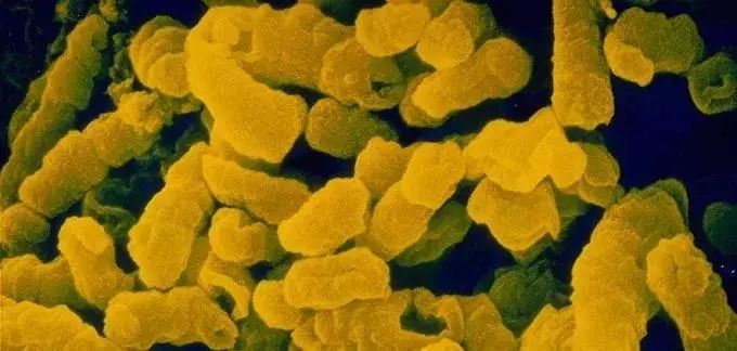 4岁要接种hib疫苗,hib疫苗成人可以接种吗