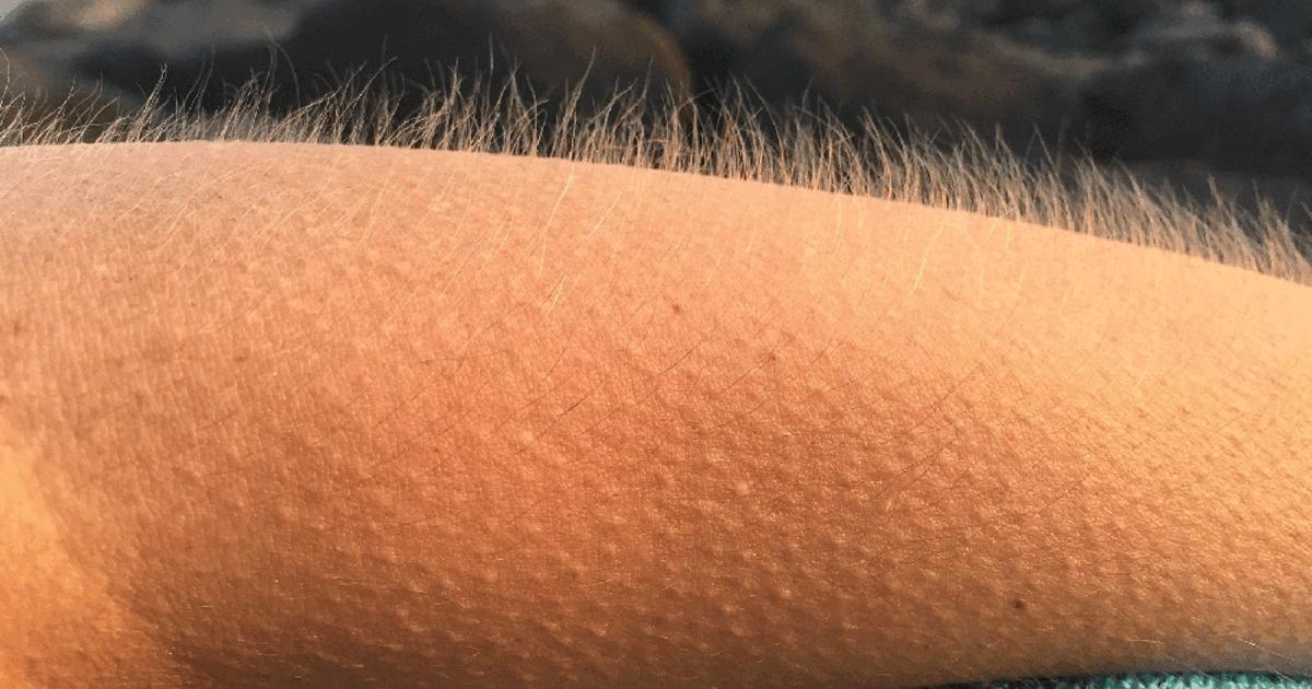 男性乳房可以喂奶吗,男性乳房是不是也能哺乳